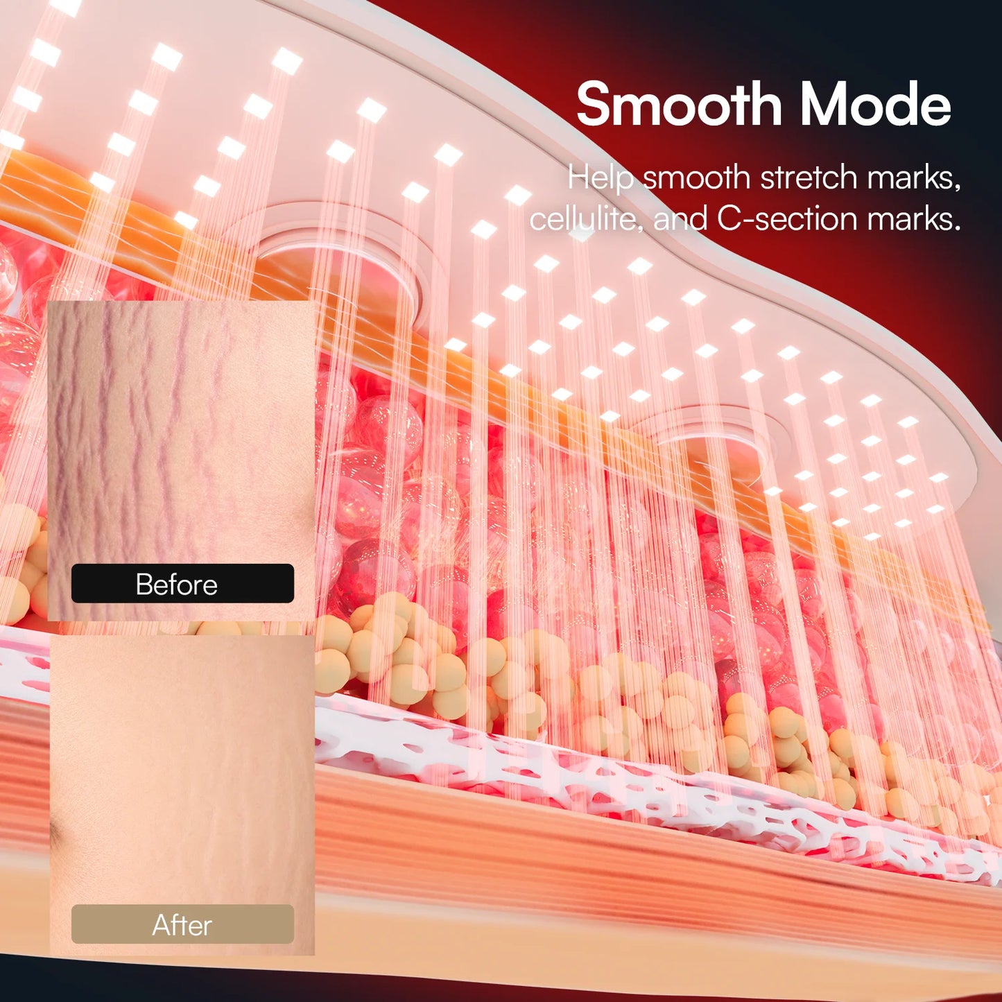 ION CORE™ Red Light EMS Core Belt